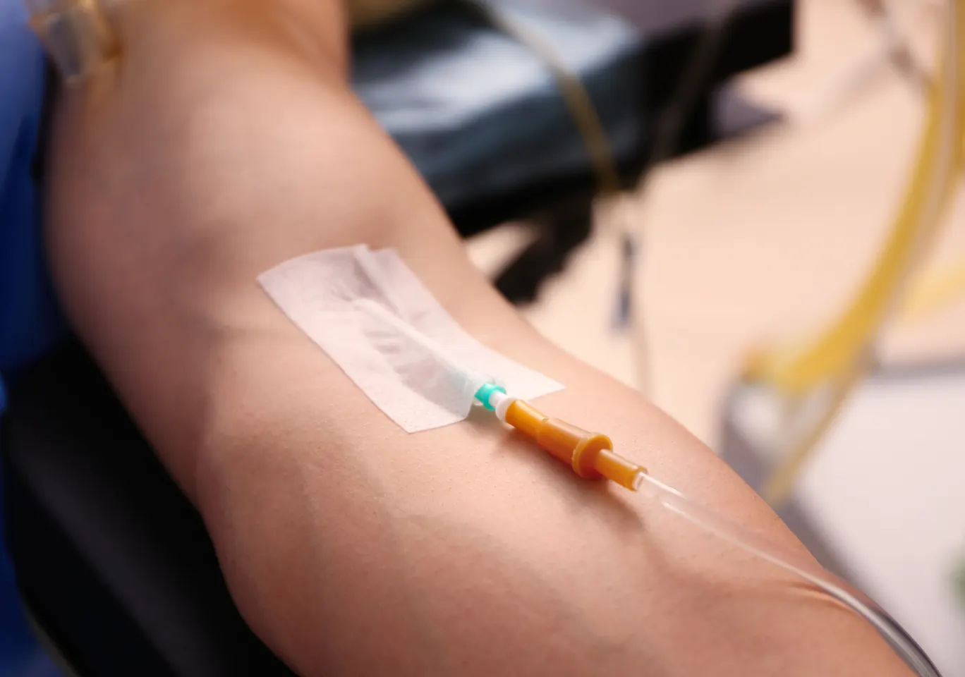Kroplówki witaminowe Dzierżoniów: przedramię z kaniulą i przezroczystym opatrunkiem